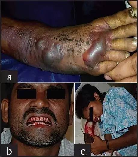 山蝰属(daboia)简明介绍!